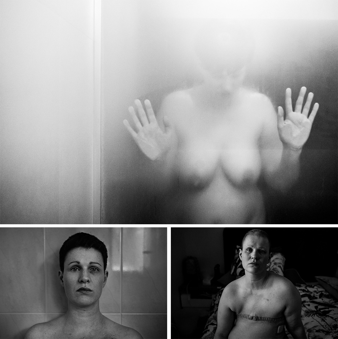 'Breast Cancer, Age 36' by Cat Leedon. Overall Winner, Australasia's Top Emerging Photographer 2023, and Winner of the Portrait category.