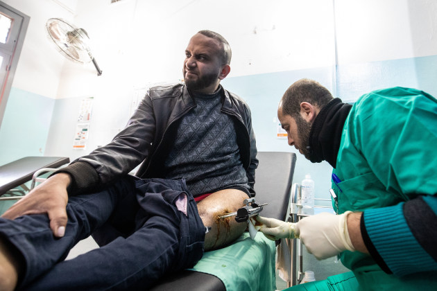 &copy; Darrian Traynor, from the series, 'More than skin deep'. GAZA. 3rd March 2020. Mahmoud Salah Shaban winces in pain as he has his external fixator cleaned.