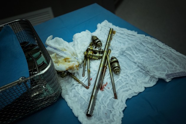 &copy; Darrian Traynor, from the series, 'More than skin deep'. GAZA. 4th March 2020. The removed external fixator.