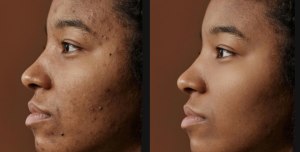 Retouch4me: smart, simple, and professional retouching for everyone