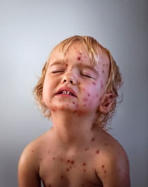 alt text for this image